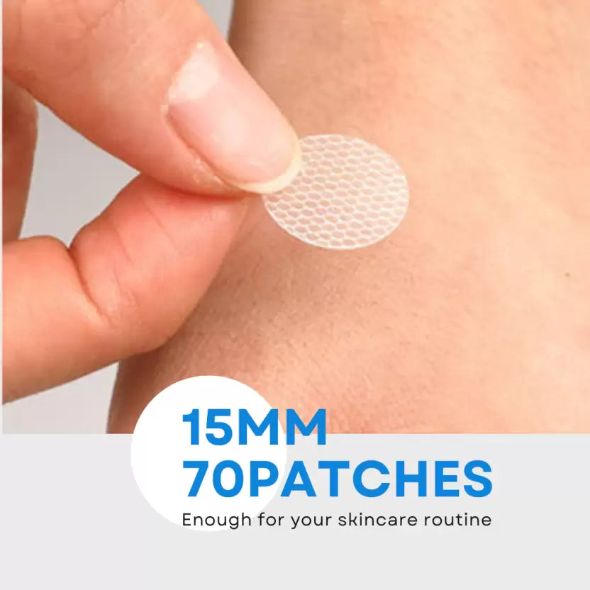 On The Go Acne Pimple Patch - 70 Patches