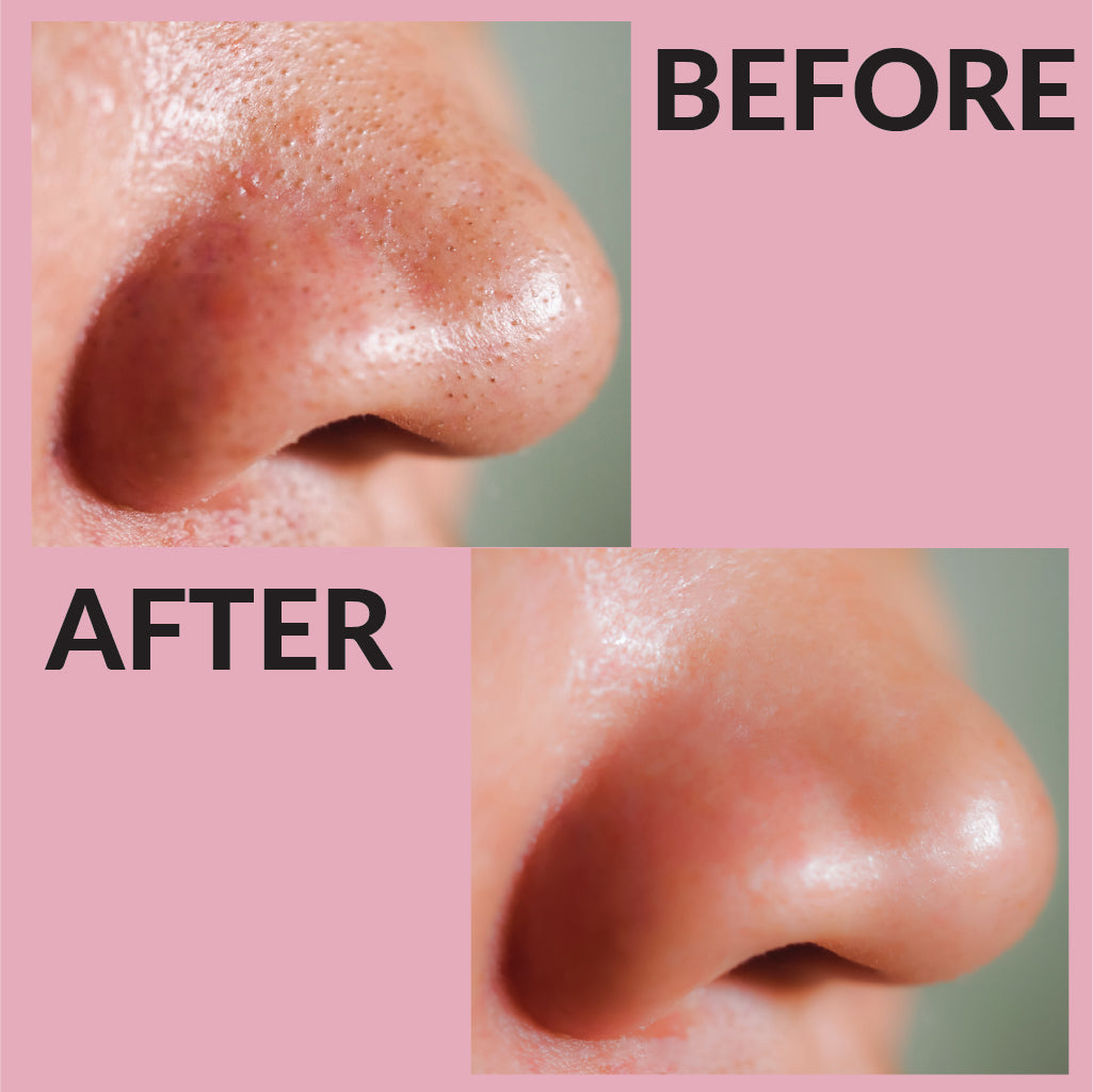 Deep Cleansing Charcoal Nose Strip