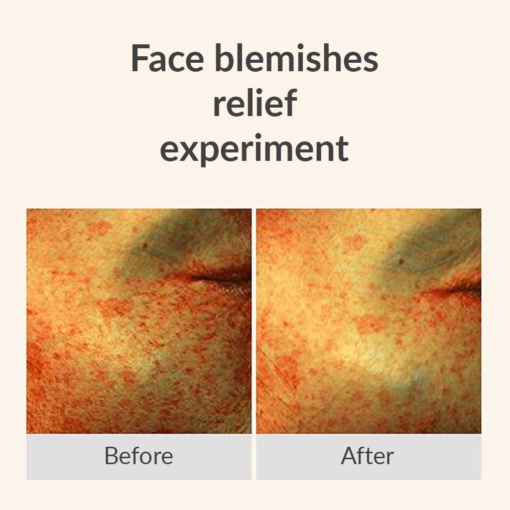 BEST - Vitamin C & E Face Serum